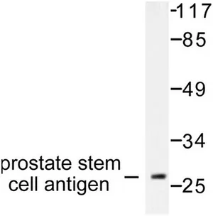 PSCA Rabbit Polyclonal Antibody - image 1