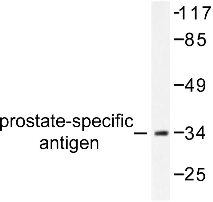 Prostate Specific Antigen (KLK3) Rabbit Polyclonal Antibody - image 1