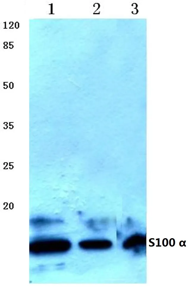 S100A1 Rabbit Polyclonal Antibody - image 1
