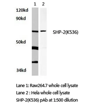 PTPN11 / PTP2C Rabbit Polyclonal Antibody - image 1