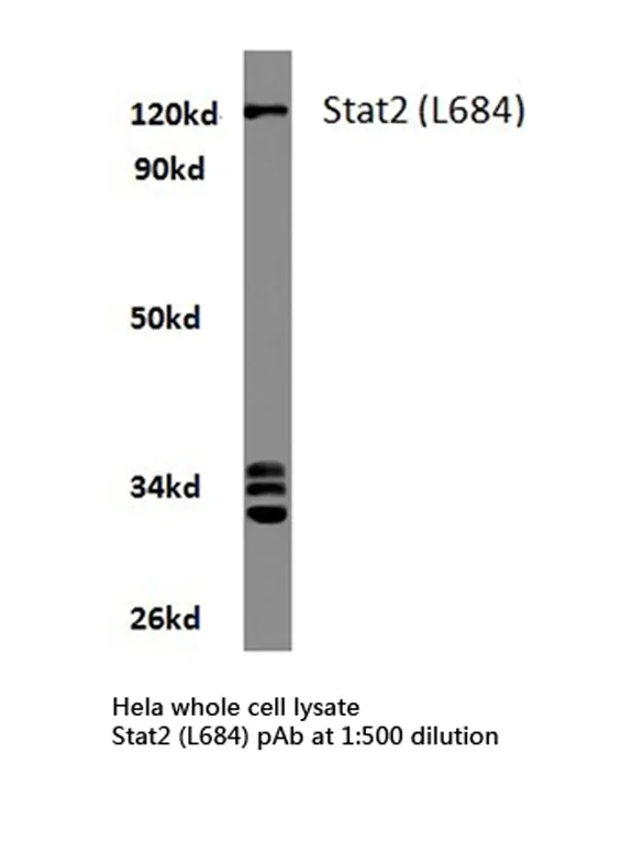 STAT2 Rabbit Polyclonal Antibody - image 1