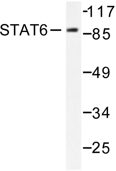 STAT6 Rabbit Polyclonal Antibody - image 1