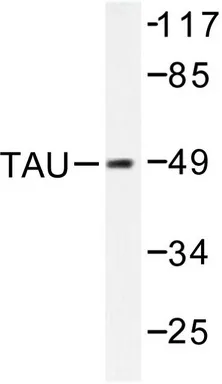 MAPT / TAU Rabbit Polyclonal Antibody - image 1