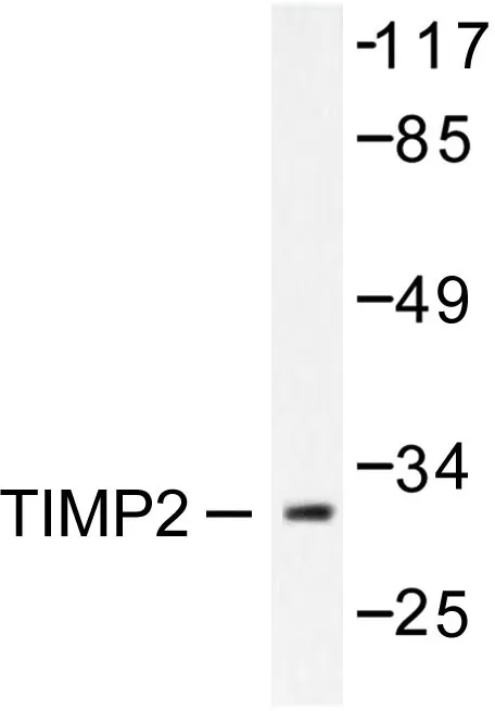 TIMP2 Rabbit Polyclonal Antibody - image 1
