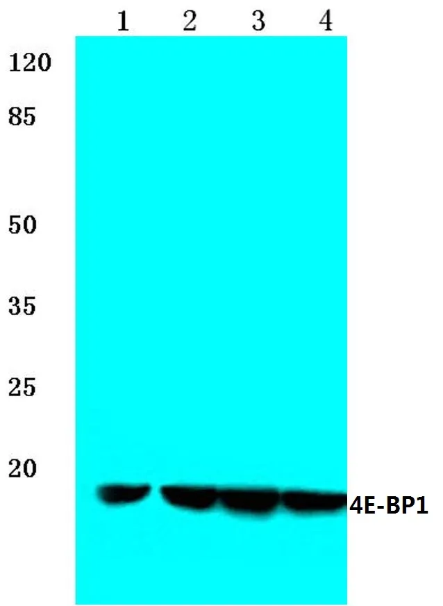 EIF4EBP1 Rabbit Polyclonal Antibody - image 1