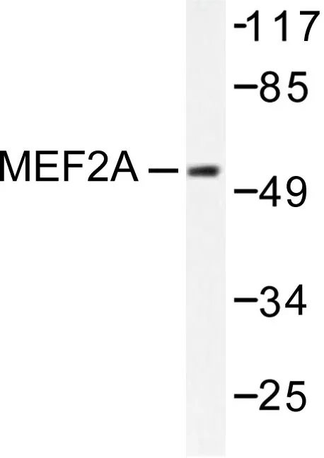 MEF2A Rabbit Polyclonal Antibody - image 1