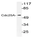 CDC25A Rabbit Polyclonal Antibody - image 1