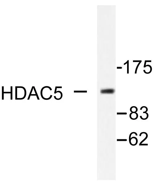 HDAC5 Rabbit Polyclonal Antibody - image 1