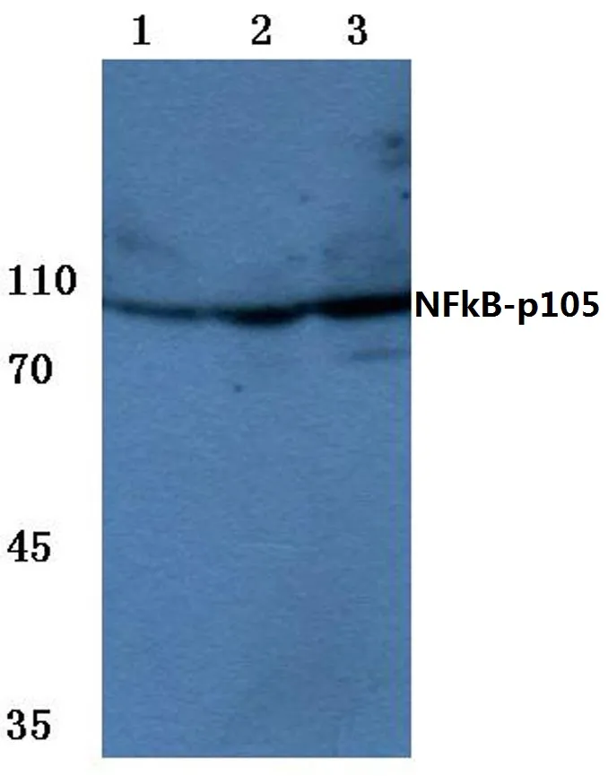 NFKB1 Rabbit Polyclonal Antibody - image 1