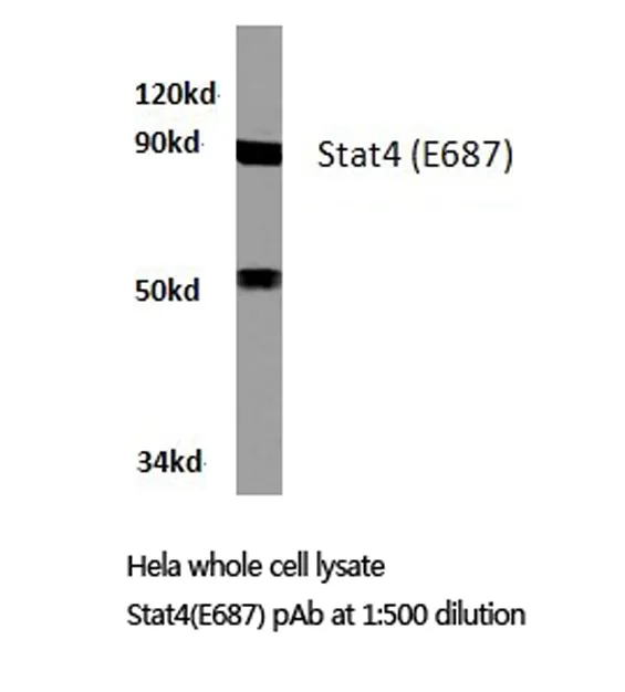 STAT4 Rabbit Polyclonal Antibody - image 1