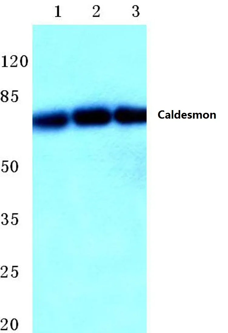 Caldesmon (CALD1) Rabbit Polyclonal Antibody - image 1