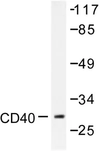 CD40 Rabbit Polyclonal Antibody - image 1