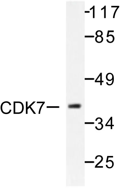 CDK7 Rabbit Polyclonal Antibody - image 1