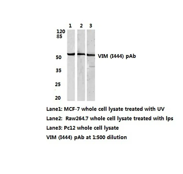 Vimentin (VIM) Rabbit Polyclonal Antibody - image 1