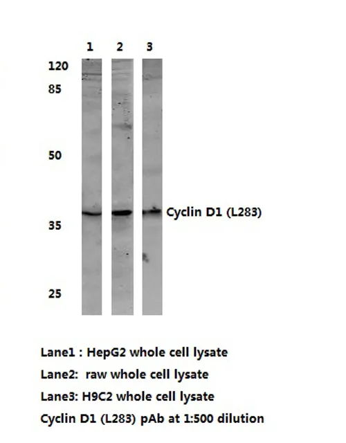Cyclin D1 (CCND1) Rabbit Polyclonal Antibody - image 1
