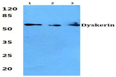 DKC1 Rabbit Polyclonal Antibody - image 1