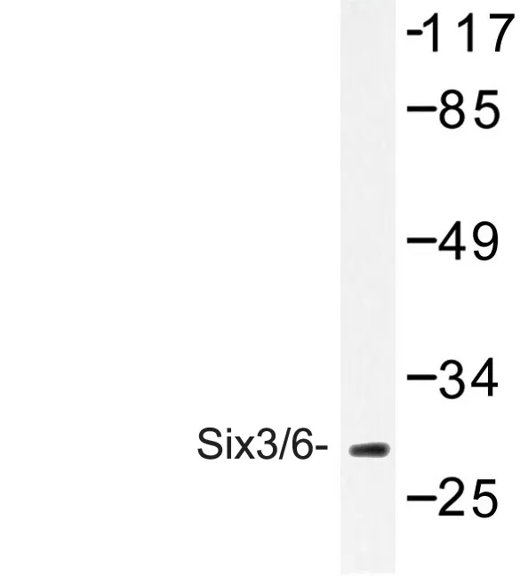SIX3 Rabbit Polyclonal Antibody - image 1