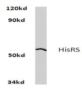 HARS Rabbit Polyclonal Antibody - image 1