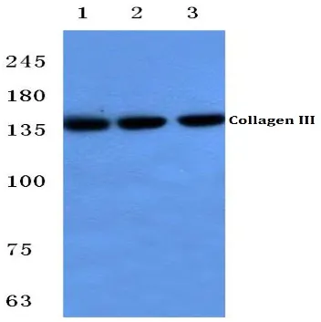 Collagen III (COL3A1) Rabbit Polyclonal Antibody - image 1