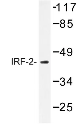 IRF2 Rabbit Polyclonal Antibody - image 1