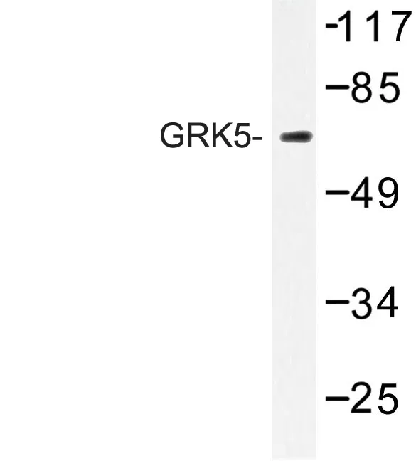 GRK5 Rabbit Polyclonal Antibody - image 1