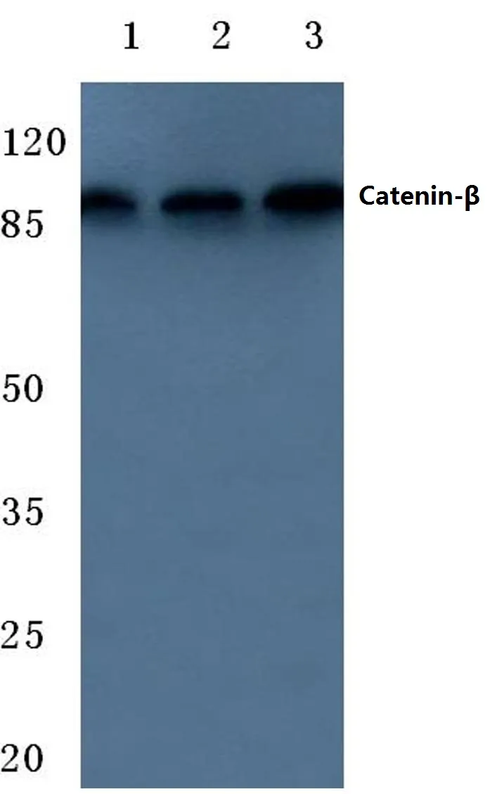 beta Catenin (CTNNB1) Rabbit Polyclonal Antibody - image 1