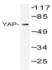 YAP1 Rabbit Polyclonal Antibody - image 1