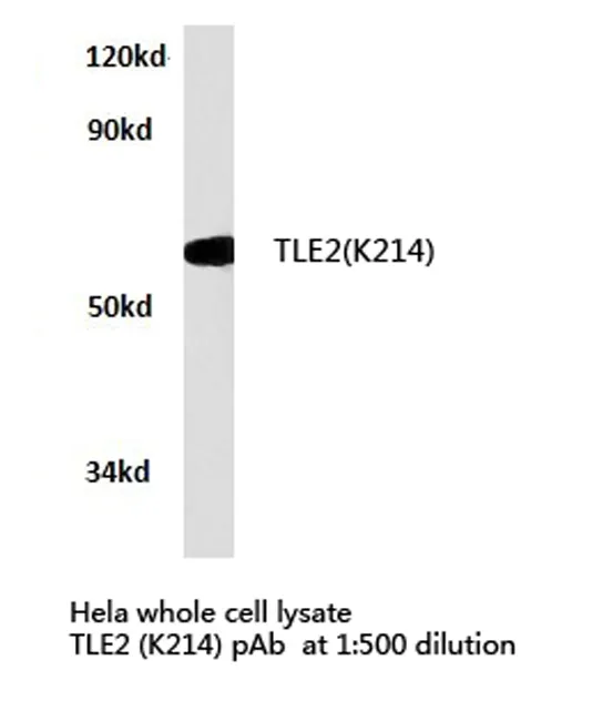 TLE2 Rabbit Polyclonal Antibody - image 1