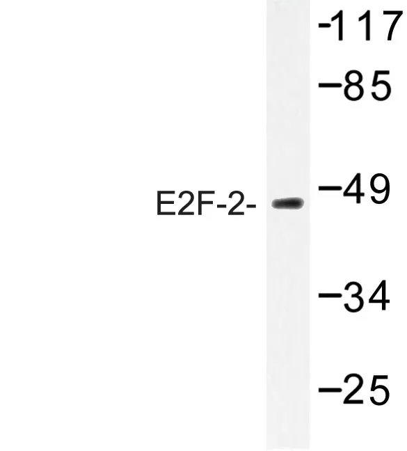 E2F2 (202-252) Rabbit Polyclonal Antibody - image 1