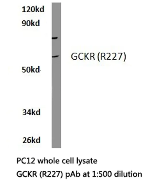 GCKR Rabbit Polyclonal Antibody - image 1