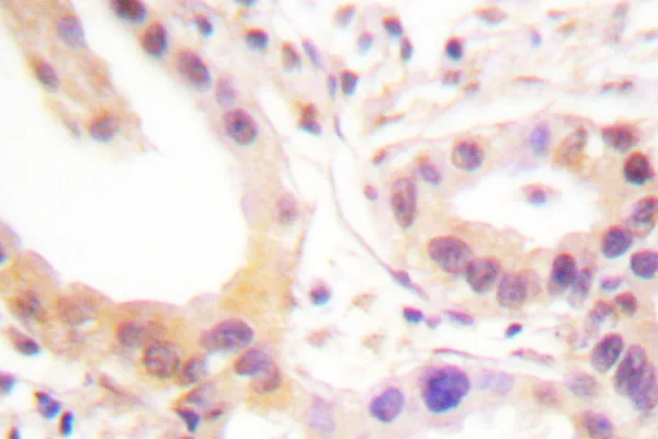 ETS1 Rabbit Polyclonal Antibody - image 1