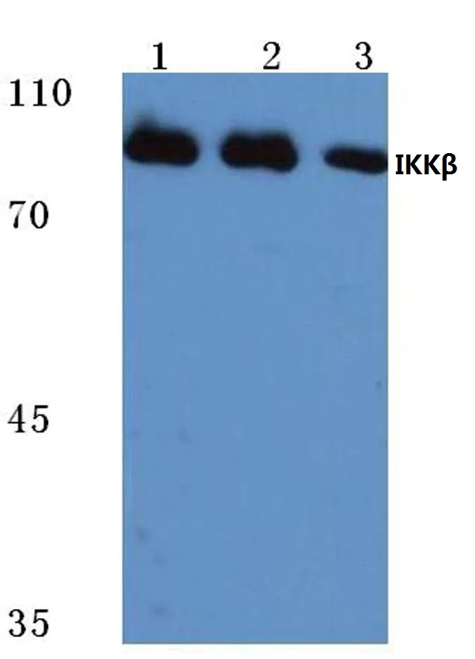 IKK beta (IKBKB) Rabbit Polyclonal Antibody - image 1