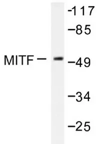 MITF Rabbit Polyclonal Antibody - image 1