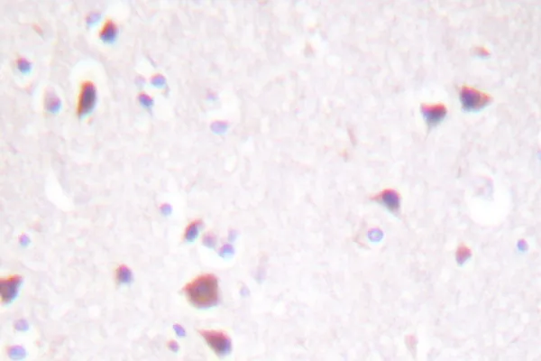 MST1 (+MST2) Rabbit Polyclonal Antibody - image 1