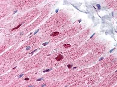 PHAP1 (ANP32A) (C-term) Rabbit Polyclonal Antibody - image 1