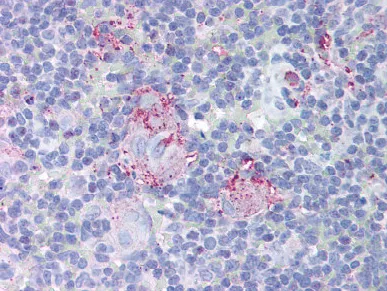 MDM2 Rabbit Polyclonal Antibody - image 1