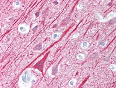 MAVS Rabbit Polyclonal Antibody - image 1