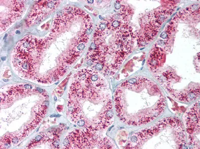 Catalase (CAT) Rabbit Polyclonal Antibody - image 1