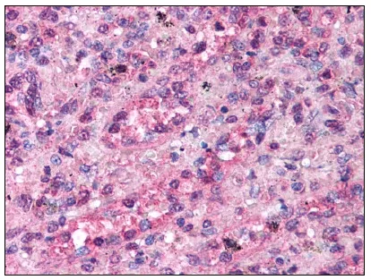 TRPC3 Rabbit Polyclonal Antibody - image 1