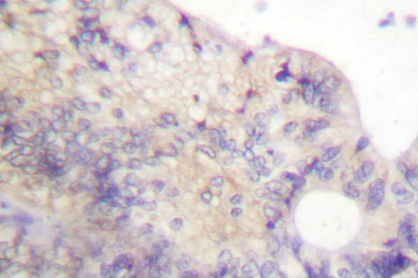 PFKFB2 Rabbit Polyclonal Antibody - image 1