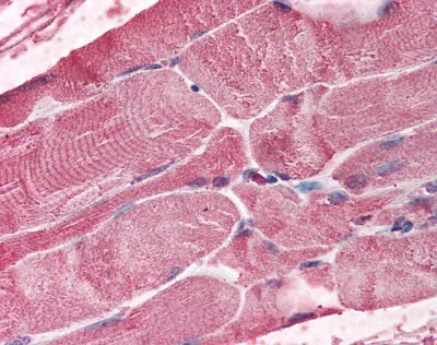 Bmi1 (COMMD3-BMI1) Goat Polyclonal Antibody - image 1