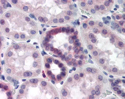 TIP120B (CAND2) Rabbit Polyclonal Antibody - image 1