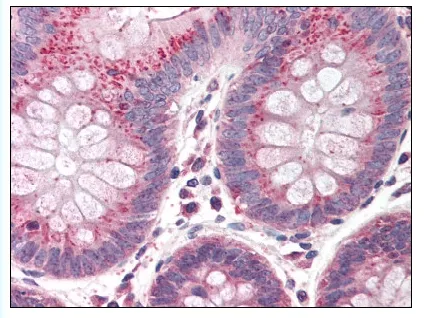 PARC (CUL9) Rabbit Polyclonal Antibody - image 1