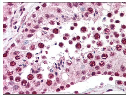 SPANX (SPANXC) Rabbit Polyclonal Antibody - image 1