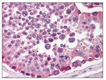 SIRP alpha (SIRPA) (C-term) Rabbit Polyclonal Antibody - image 1