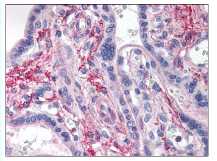 LAMP2 Rabbit Polyclonal Antibody - image 1