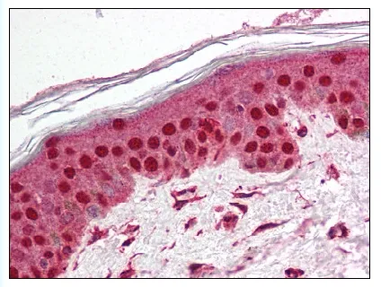TEP1 Rabbit Polyclonal Antibody - image 1