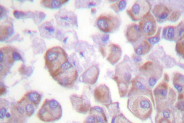 alpha Synuclein (SNCA) Rabbit Polyclonal Antibody - image 1