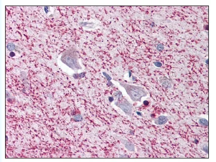 TRIM5 alpha (TRIM5) Rabbit Polyclonal Antibody - image 1