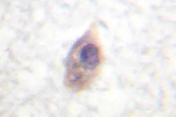 CDC25B Rabbit Polyclonal Antibody - image 1